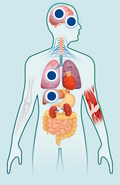 Parassiti negli esser umani